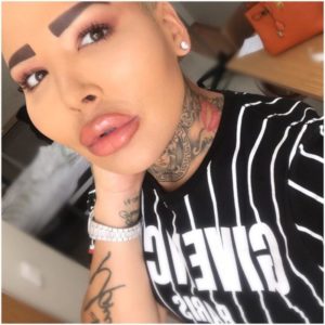 5 terribles cirugías plásticas de las famosas