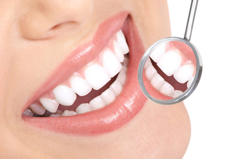 Impianto dentale: tutti i vantaggi