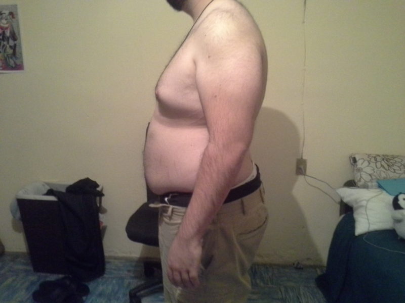 Obesity: definition, symptoms, classification, consequences and measures