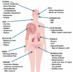 Fibromyalgia Treatment Options