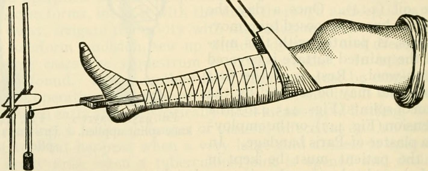 New Injection For Knee Pain: benefits