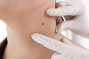 Mini Neck Lift Cost: they may not end at the surgery table