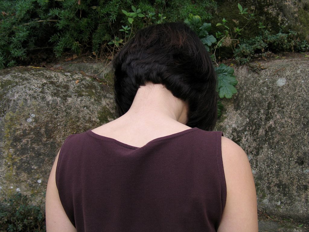 The Purpose of a Neck Fusion Procedure