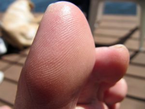 What Causes Big Toe Pain?